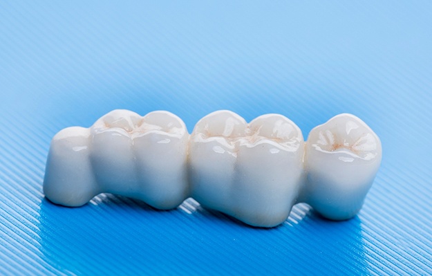 A man smiling at the dentist