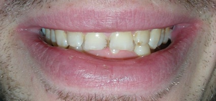 case 11 before