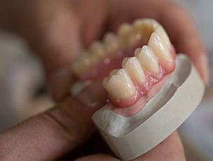 a set of dentures on a wax model