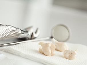 Teeth on a tray after tooth extraction 