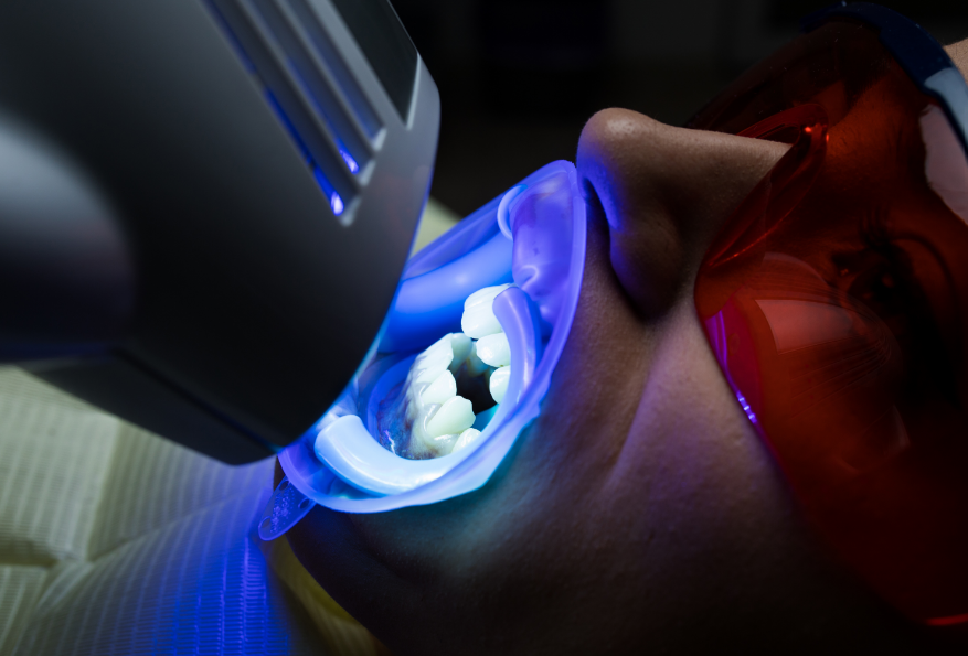 Patient getting teeth whitening treatment